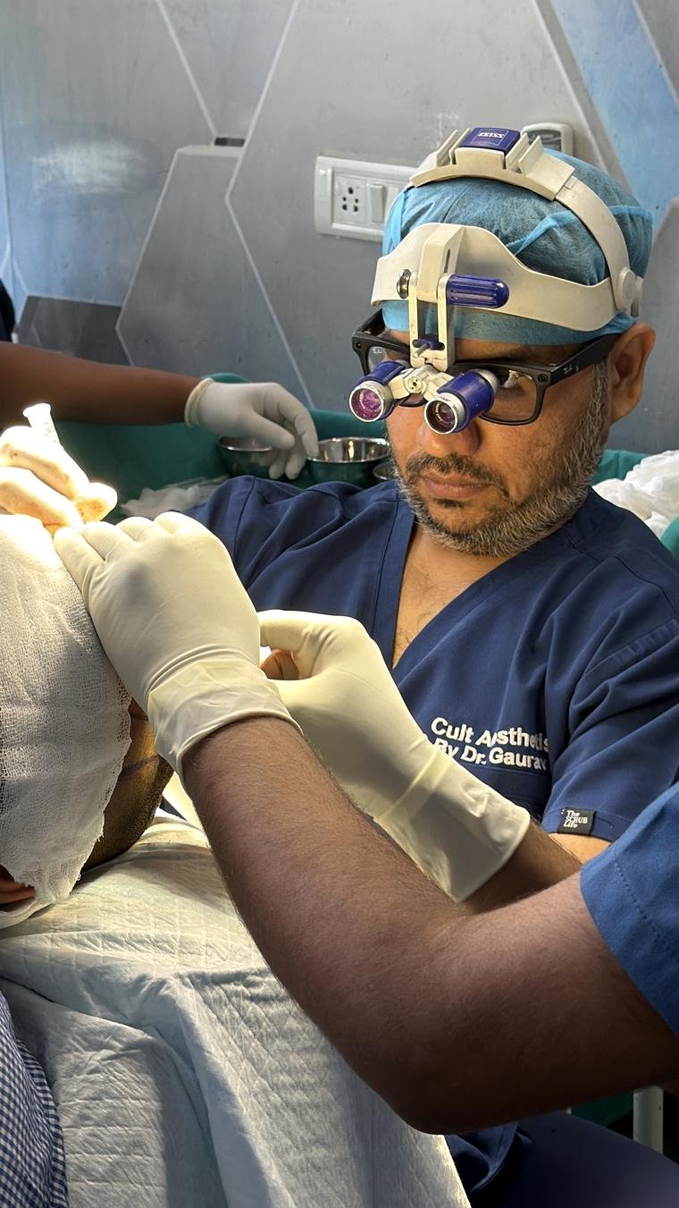 Dr Gaurav Solanki performing a hair transplant at Cult Aesthetics, Gurgaon